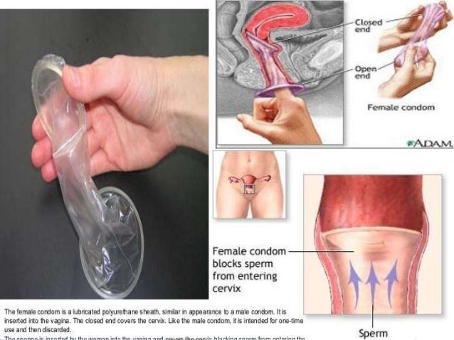 Cut tit bdsm Sperm cells and condoms